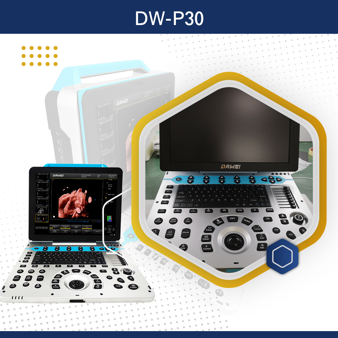 Portable Color Doppler USG (Dw-P30)